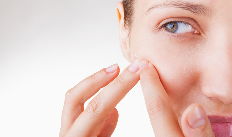 7 Habits That Could Worsen Your Acne Problem